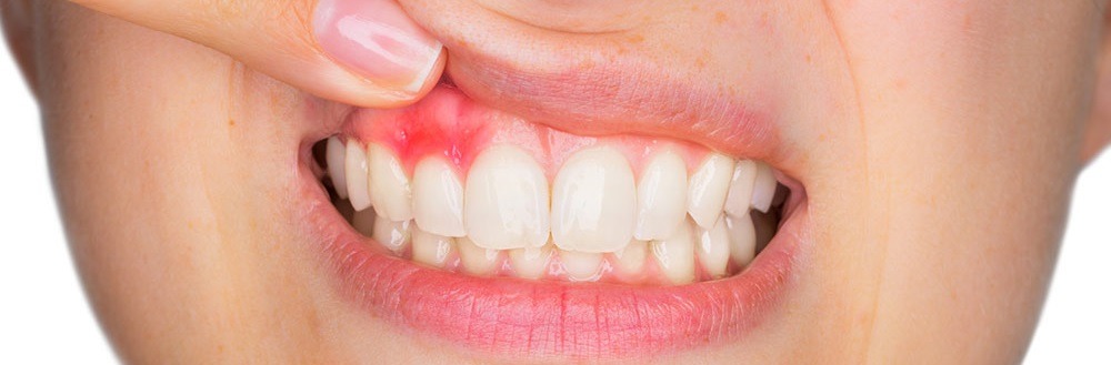 Que tipo de procedimentos um periodontista realiza?